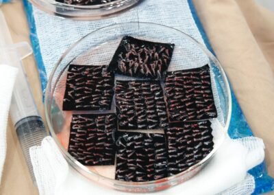 FUE method for natural hair regrowth