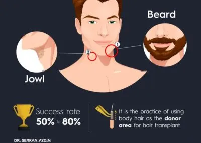 Body Hair Transplant Services