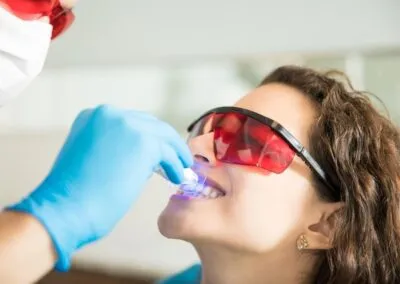 Dental Treatments Teeth Whitening