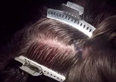 Executive Non-Shaving therapies