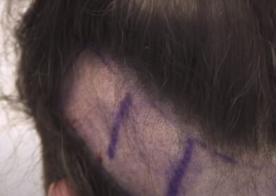 Executive Non-Shaving with professionals