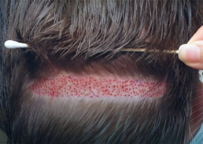 Executive Non-Shaving