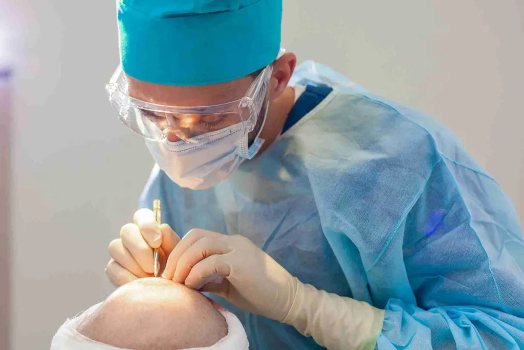 Hair Transplant in Turkey