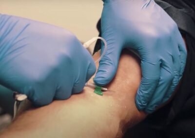 PRP Hair Treatment in istanbul