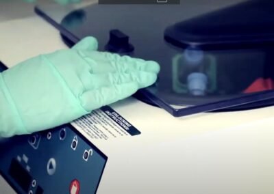 Effective PRP Hair Therapy