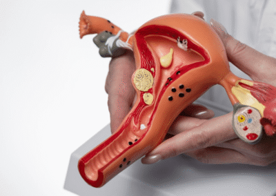 Reproduction Treatment