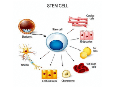 stem cell therapy
